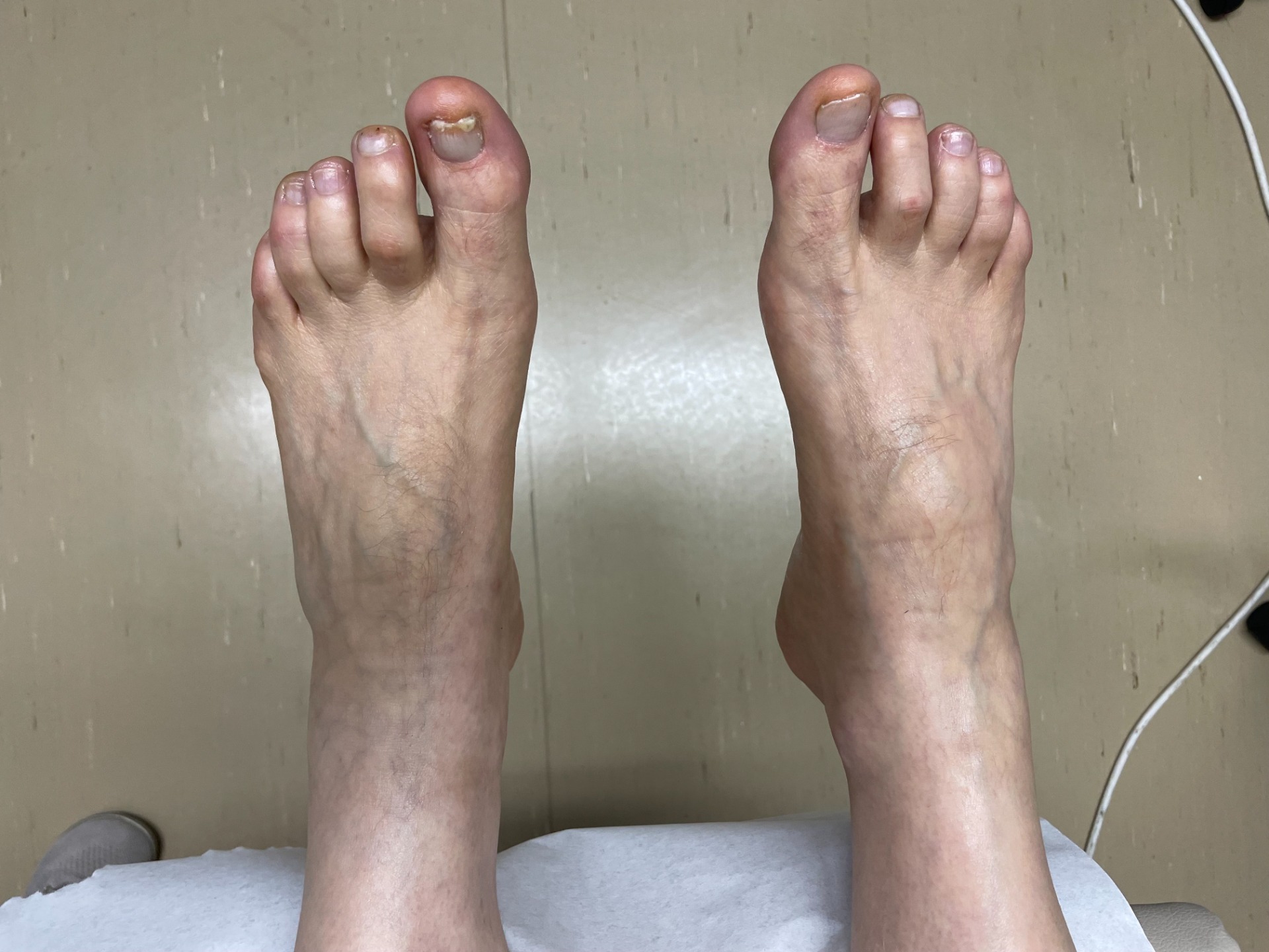 Parasta jalkojenhoitoa sinulle